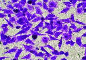 transwell遷移侵襲實驗